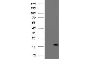 Image no. 1 for anti-P53 and DNA-Damage Regulated 1 (PDRG1) antibody (ABIN2728603)