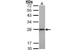 Image no. 3 for anti-Transgelin (TAGLN) (Center) antibody (ABIN2855103)