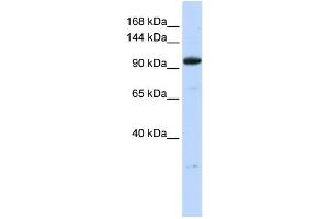Image no. 1 for anti-Zinc Finger Protein 112 (ZFP112) (N-Term) antibody (ABIN2780902)