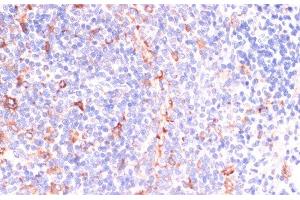 Immunohistochemistry of paraffin-embedded Rat spleen using IKBKE Polyclonal Antibody at dilution of 1:200 (40x lens).