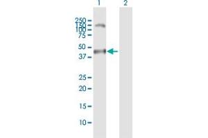 Image no. 1 for anti-Melanoma Antigen Family A, 11 (MAGEA11) (AA 1-319) antibody (ABIN517705)