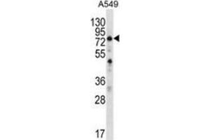 Image no. 1 for anti-Spermatogenesis Associated 7 (SPATA7) (AA 341-369), (C-Term) antibody (ABIN954913)