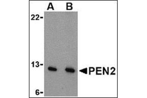 Image no. 2 for anti-Presenilin Enhancer 2 Homolog (PSENEN) (N-Term) antibody (ABIN500473)