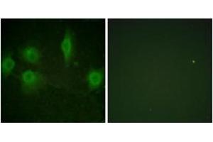 Immunofluorescence analysis of HuvEc cells, using IL-9R (Phospho-Ser519) Antibody.