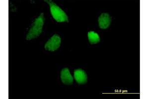 Immunofluorescence of purified MaxPab antibody to ZNF394 on HeLa cell.
