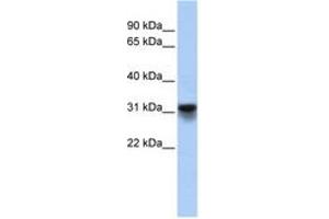 Image no. 1 for anti-KDEL (Lys-Asp-Glu-Leu) Endoplasmic Reticulum Protein Retention Receptor 3 (kDELR3) (AA 71-120) antibody (ABIN6743435)