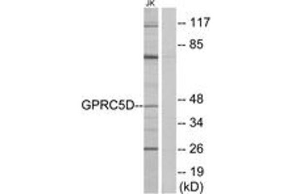 anti-G Protein-Coupled Receptor, Family C, Group 5, Member D (GPRC5D) (AA 271-320) antibody