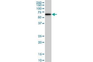 Image no. 9 for anti-V-Akt Murine Thymoma Viral Oncogene Homolog 3 (Protein Kinase B, Gamma) (AKT3) (AA 100-189) antibody (ABIN564308)