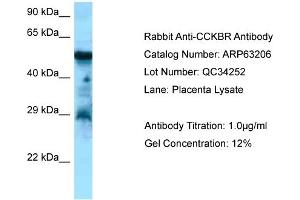 Image no. 1 for anti-Cholecystokinin B Receptor (CCKBR) (C-Term) antibody (ABIN2789413)