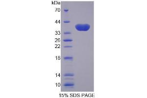 Image no. 1 for Solute Carrier Family 25 (Mitochondrial Carrier, Oxoglutarate Carrier), Member 11 (SLC25A11) (AA 1-314) protein (His tag) (ABIN6239635)