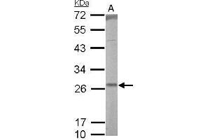 Image no. 3 for anti-Ras-related Protein Ral-A (rala) (Center) antibody (ABIN2856955)
