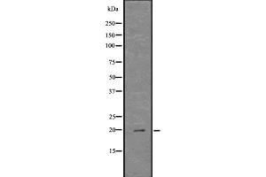 Image no. 2 for anti-Cathelicidin Antimicrobial Peptide (CAMP) antibody (ABIN6260498)