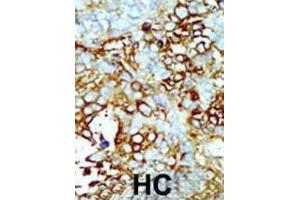 Image no. 1 for anti-Mitogen-Activated Protein Kinase Kinase Kinase Kinase 2 (MAP4K2) antibody (ABIN2971016)