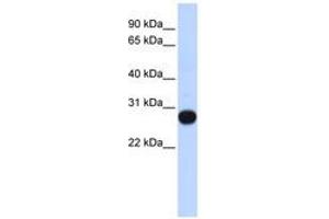 Image no. 1 for anti-Transcription Elongation Factor A (SII)-Like 4 (TCEAL4) (AA 107-156) antibody (ABIN6741080)