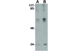 Image no. 3 for anti-serine threonine Kinase 39 (STK39) (C-Term) antibody (ABIN6655988)