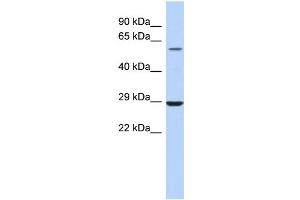 Image no. 1 for anti-Lysophosphatidylcholine Acyltransferase 1 (LPCAT1) (Middle Region) antibody (ABIN2783952)