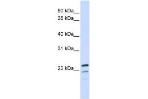 Image no. 1 for anti-Receptor Accessory Protein 1 (REEP1) (Middle Region) antibody (ABIN635814)