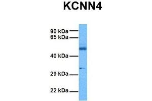 Image no. 2 for anti-Potassium Intermediate/small Conductance Calcium-Activated Channel, Subfamily N, Member 4 (KCNN4) (C-Term) antibody (ABIN2776147)