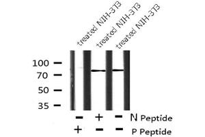 Image no. 1 for anti-FER Tyrosine Kinase (FER) (pTyr714) antibody (ABIN6271460)