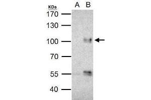 Image no. 3 for anti-Forkhead Box O3 (FOXO3) (C-Term) antibody (ABIN2854686)