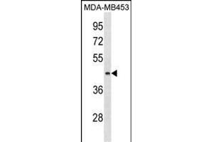 ALG8 Antibody (N-term) (ABIN1539057 and ABIN2850016) western blot analysis in MDA-M cell line lysates (35 μg/lane).