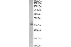 Image no. 2 for anti-Cyclin-Dependent Kinase Inhibitor 1B (p27, Kip1) (CDKN1B) (Internal Region) antibody (ABIN185582)