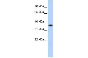 Image no. 1 for anti-Motor Neuron and Pancreas Homeobox 1 (MNX1) (N-Term) antibody (ABIN2777509)