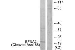 Image no. 1 for anti-Ephrin A2 (EFNA2) (AA 139-188), (Cleaved-Asn188) antibody (ABIN1536129)
