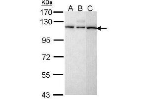Image no. 1 for anti-Squamous Cell Carcinoma Antigen Recognized By T Cells (SART1) (C-Term) antibody (ABIN2856790)