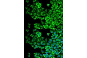 Image no. 2 for anti-Hemopoietic Cell Kinase (HCK) antibody (ABIN3022864)