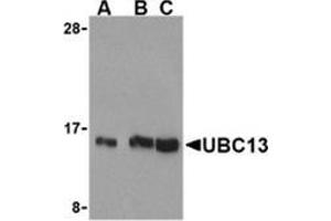 Image no. 2 for anti-Ubiquitin-Conjugating Enzyme E2N (UBE2N) (C-Term) antibody (ABIN501096)