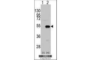 Image no. 1 for anti-SET and MYND Domain Containing 2a (SMYD2A) (AA 120-152), (N-Term) antibody (ABIN387897)