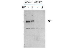Image no. 2 for anti-Denticleless E3 Ubiquitin Protein Ligase Homolog (DTL) (C-Term) antibody (ABIN2451940)