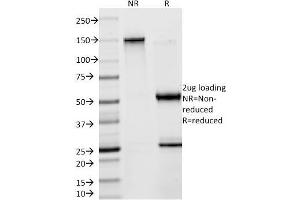 Image no. 1 for anti-Creatine Kinase, Brain (CKB) antibody (ABIN6939143)