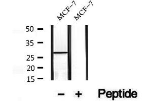 Image no. 2 for anti-Mitochondrial Fission Factor (MFF) (pSer172) antibody (ABIN6255023)