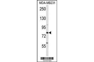 Image no. 1 for anti-ADAM Metallopeptidase Domain 9 (ADAM9) (AA 704-733), (C-Term) antibody (ABIN652337)
