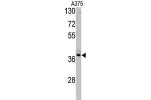 Image no. 1 for anti-Transaldolase 1 (TALDO1) (Middle Region) antibody (ABIN453406)