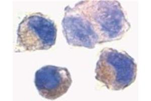 Image no. 3 for anti-ADAM Metallopeptidase Domain 10 (ADAM10) (AA 732-748) antibody (ABIN319033)