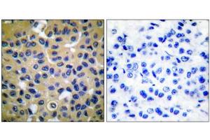 COL2 anticorps  (N-Term)