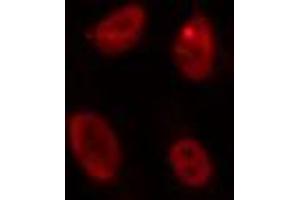 Image no. 2 for anti-Inhibitor of DNA Binding 4, Dominant Negative Helix-Loop-Helix Protein (ID4) antibody (ABIN6258853)