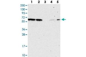 Image no. 2 for anti-NEDD8 Activating Enzyme E1 Subunit 1 (NAE1) antibody (ABIN5584168)