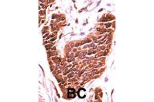 Image no. 2 for anti-BR serine/threonine Kinase 2 (BRSK2) (AA 706-736), (C-Term) antibody (ABIN391285)