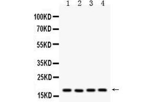 Image no. 1 for anti-Peptidylprolyl Isomerase A (Cyclophilin A) (PPIA) (AA 116-165) antibody (ABIN5518864)