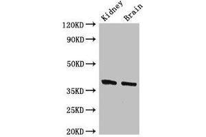 FOXE1 anticorps  (AA 184-365)