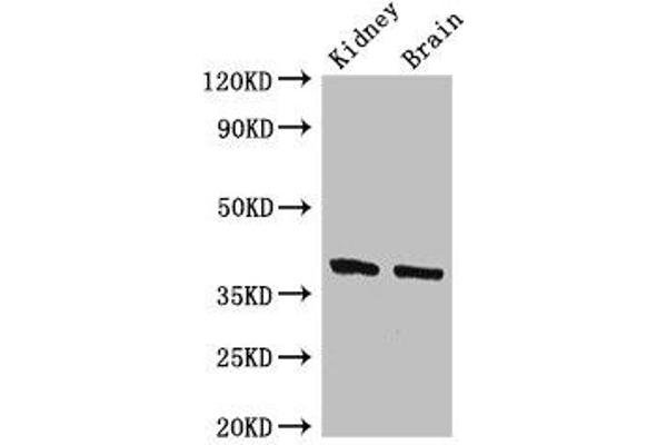 FOXE1 anticorps  (AA 184-365)