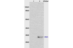Image no. 3 for anti-Interleukin 6 (IL6) (AA 111-150) antibody (ABIN728083)