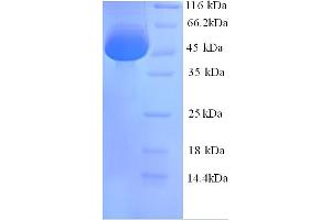 Image no. 1 for Calreticulin (CALR) (AA 18-416) protein (His tag) (ABIN5713308)