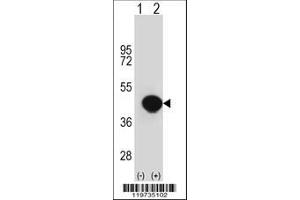 Image no. 3 for anti-Biglycan (BGN) (AA 148-176) antibody (ABIN390701)