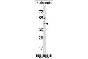 Image no. 1 for anti-Pregnancy Specific beta-1-Glycoprotein 6 (PSG6) (AA 22-48), (N-Term) antibody (ABIN1539188)