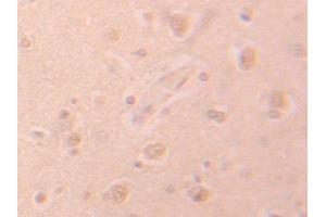 Image no. 3 for anti-phosphohistidine Phosphatase 1 (PHPT1) (AA 1-125) antibody (ABIN1176627)